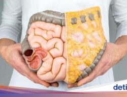 Peristiwa Pidana Hukum Kanker Usus Besar Di Usia Muda Melonjak, Waspadai Gejalanya