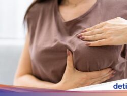 Payudara Kiri Wanita Ini Membesar Secara Tak Normal, Beratnya Lebih Didalam 3 Kg