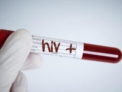 Begini Ciri-ciri HIV yang Muncul Ke Kemaluan Pria