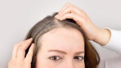 Masih Muda tapi Rambut Sudah Beruban? Bisa Karena Itu Ini Penyebabnya