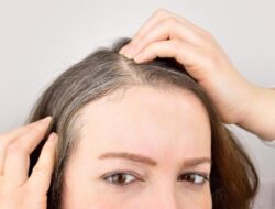 Masih Muda tapi Rambut Sudah Beruban? Bisa Karena Itu Ini Penyebabnya