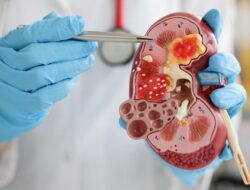 5 Tanda-Tanda ‘Tersembunyi’ Gagal Ginjal yang Kerap Tak Disadari