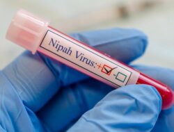 Epidemiolog Wanti-wanti Tren Patogen Nipah Di India, Soroti Potensi Wabah Di RI