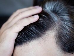 Viral Gaya Suntik ‘Terapi Uban’ Hingga China, Rambut Putih Diklaim Bisa Kembali Hitam