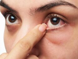 Tanda SePeLe Mata Kering Jangan Disepelekan, Atasi Bersama Insto Dry Eyes