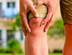 Kaki Nyeri gegara Asam Urat Kambuh, Begini 5 Cara Sederhana Mengatasinya