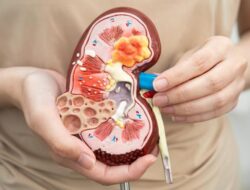 Jari Tangan Wanita Ini Terpaksa Diamputasi, Berawal Didalam Keluhan Batu Ginjal