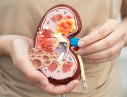 Puasa Bisa Karena Itu Momen ‘Detoks’ Ginjal, Urolog Beberkan Caranya
