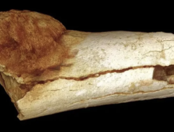 Fosil Purba Berusia 1,7 Juta Tahun Ungkap Manusia Pertama yang Kena Kanker