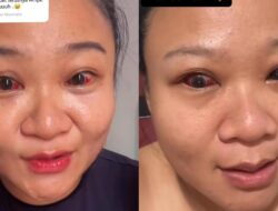 Viral Mata Wanita Memerah Usai Melahirkan, Diduga gegara Merem Di Ngejan